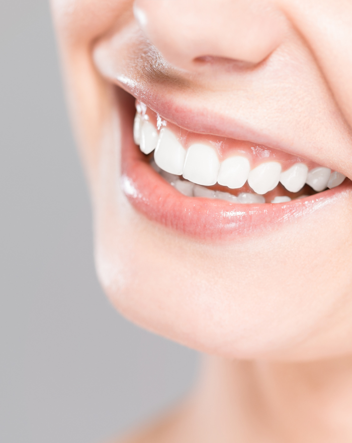 ホワイトニング後の笑顔